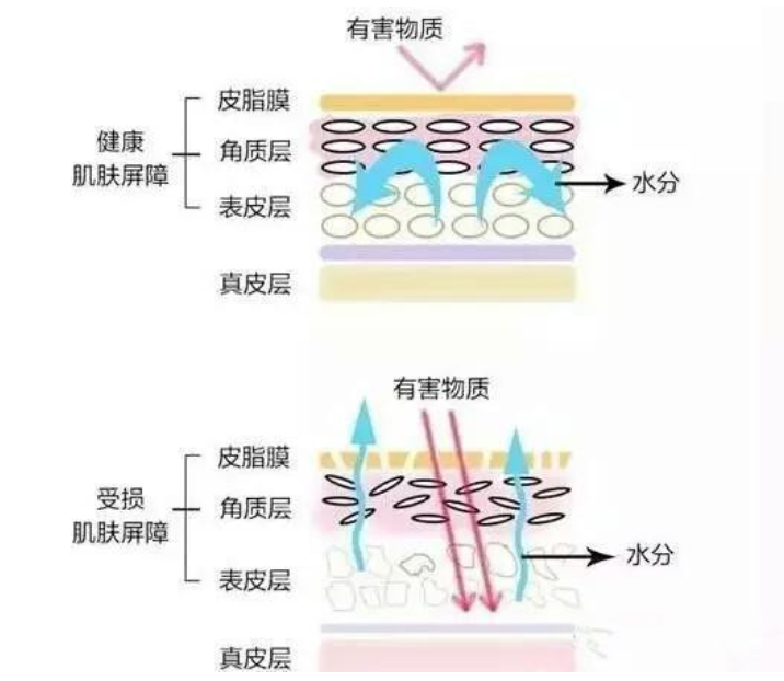 干、癢、紅、腫？別慌涂護膚品，先看看皮膚屏